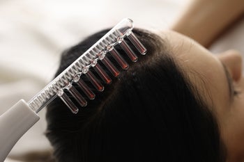 dimethicone hair loss lawsuit
