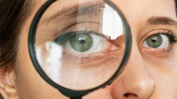 Health: Autoimmune: dry eye magnifying glass-1371303440