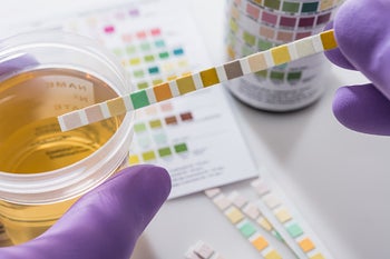 Health: UTI: GettyImages-1074853998