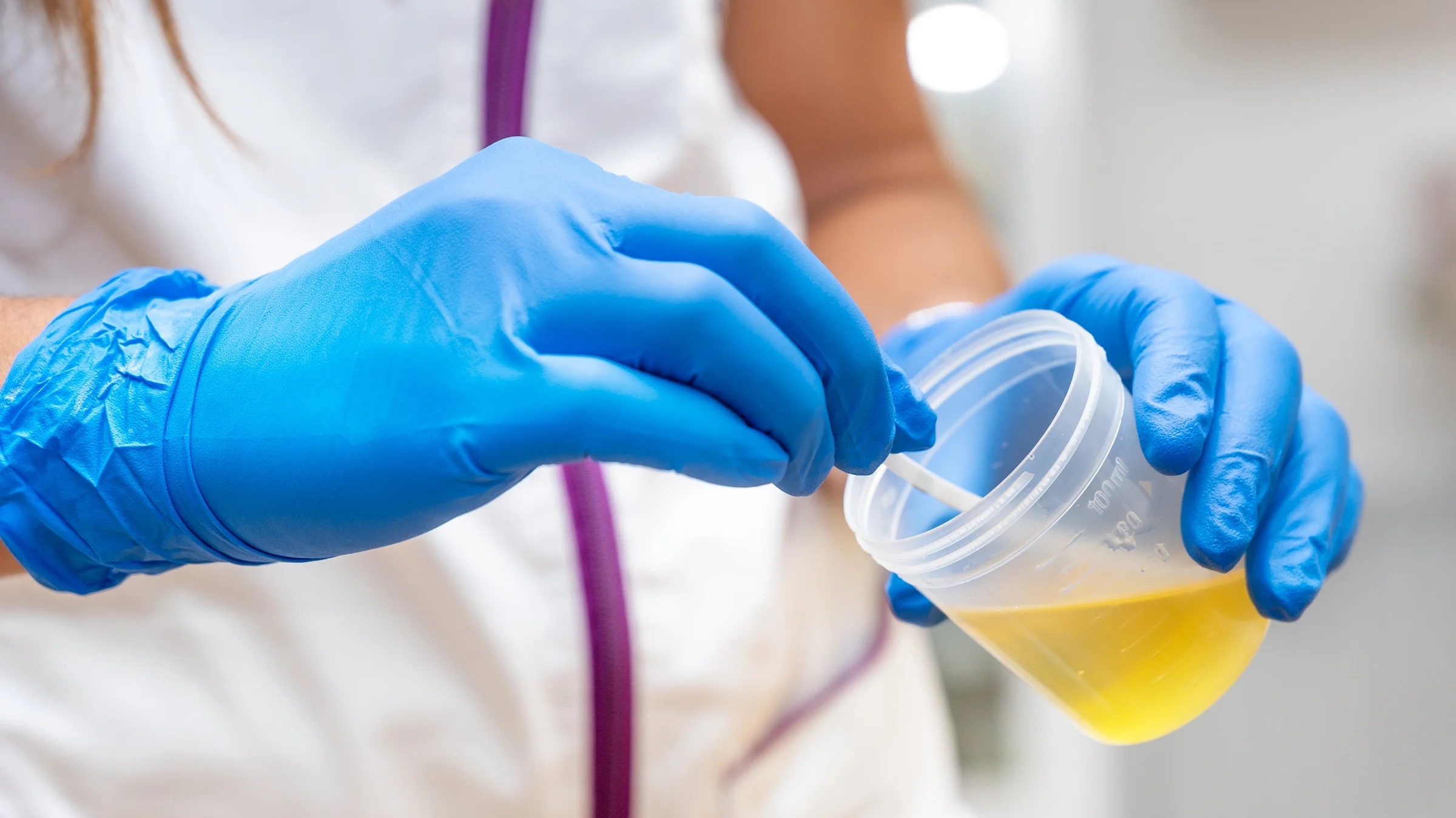 Close-up urine sample