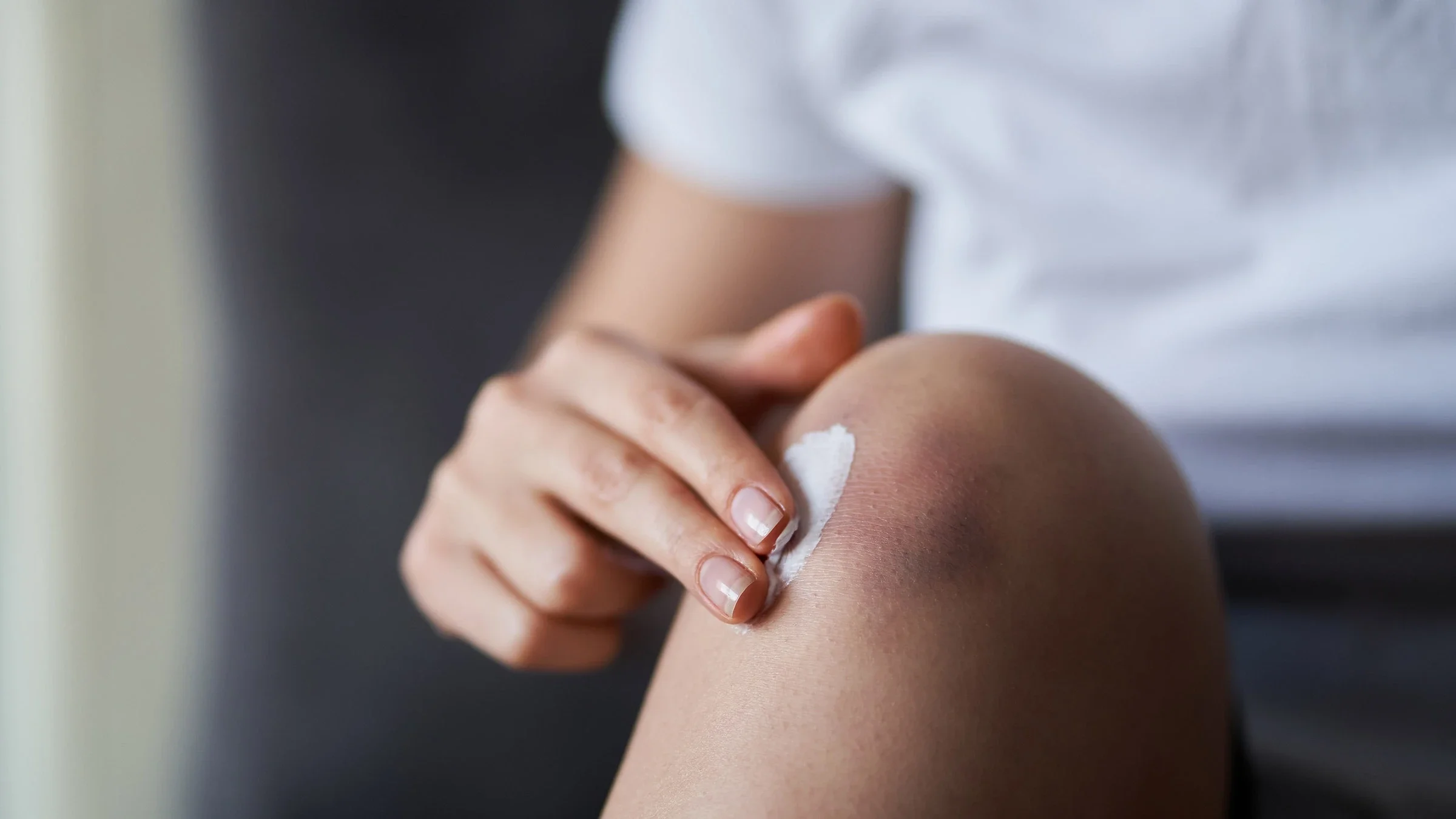A person applying medication on a bruise on their leg.