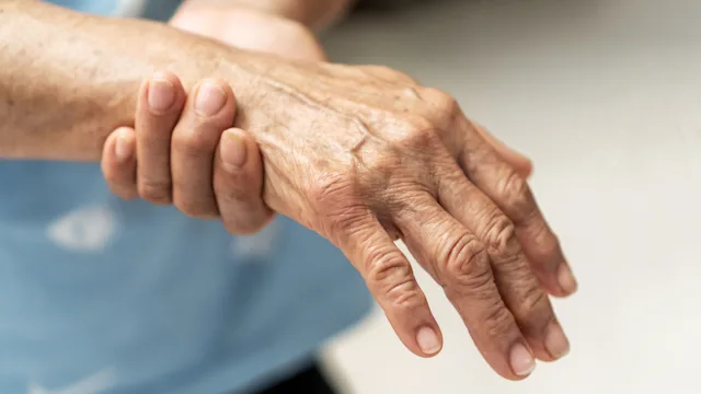 10 of the Most Unusual Medication Side Effects You Should Know About