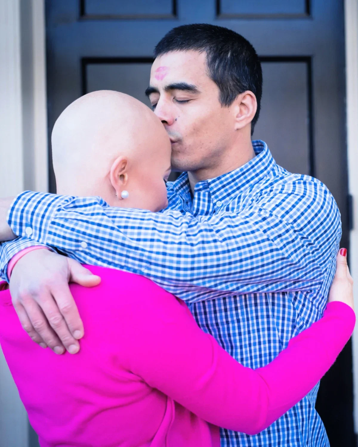 Anna Crollman’s husband, Mac, is pictured kissing her on top of her bald head.