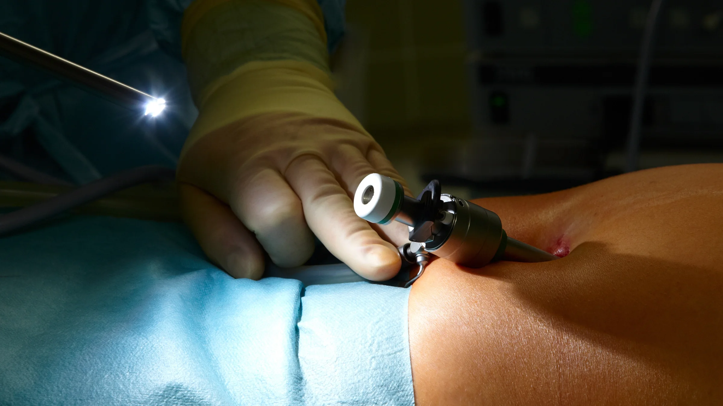A close-up of a laparoscopic surgery.