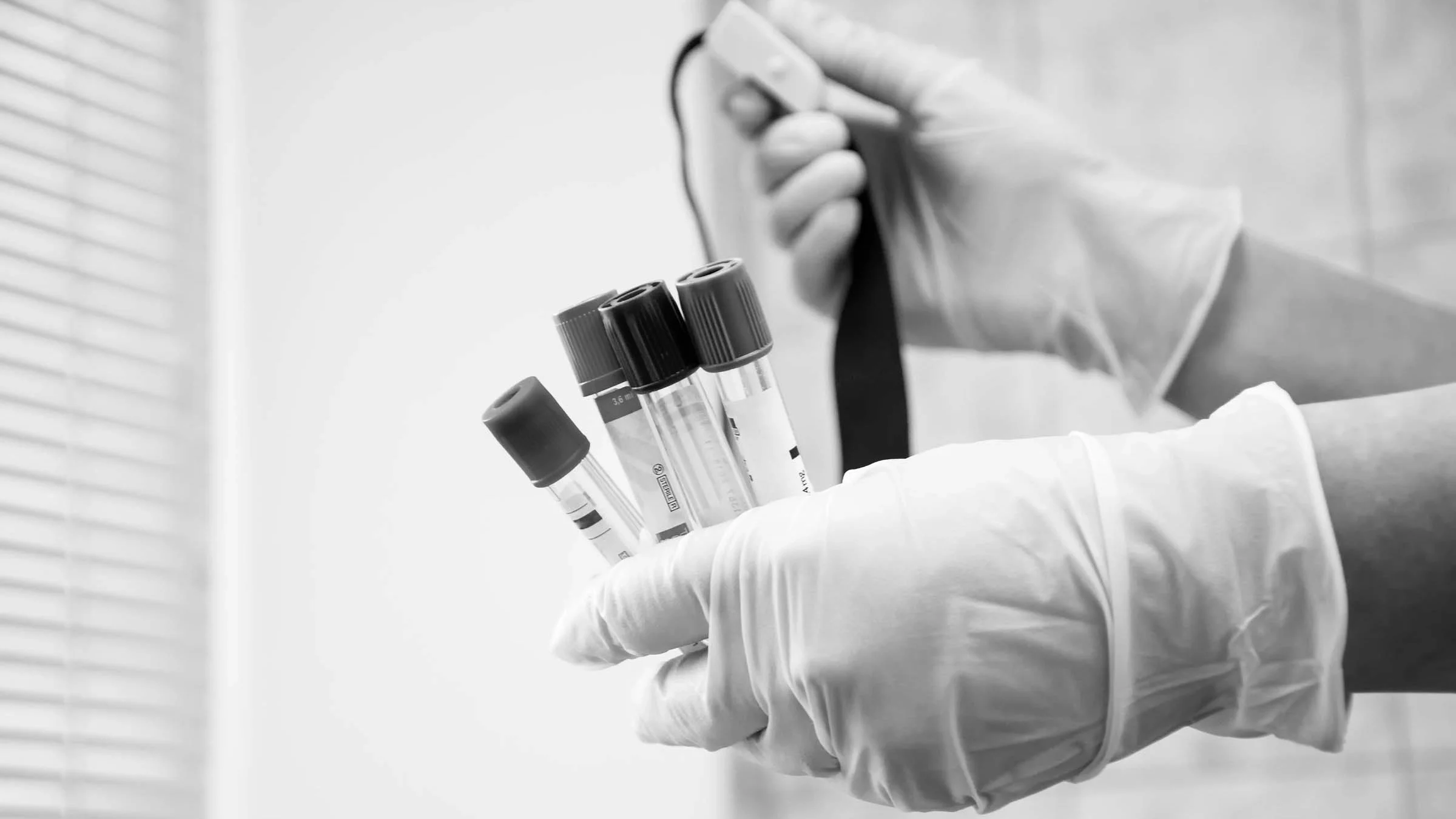 Close-up on a doctor or lab tech holding test tubes for an electrolyte panel test.
