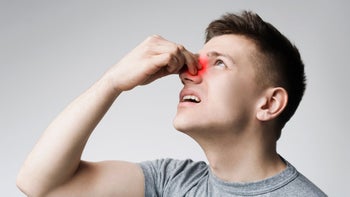 Nasal Polyps: Nasal Congestion: Cold: Allergies: man with nose pain 1166775553