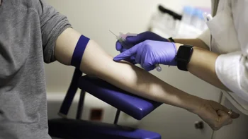 hematology: getting blood drawn 1128889407