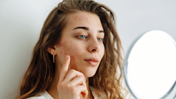 A woman with acne is looking at herself in the mirror.
Maksym Belchenko/iStock via Getty Images