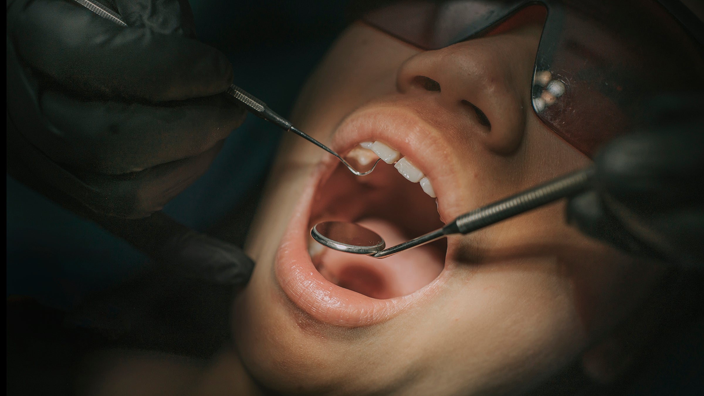 Top 27 how much do teeth implants cost 1 How Much Do Dental Implants Cost?