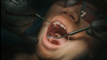 procedures: dental: closeup mouth open dental exam 1288230147
