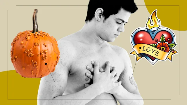 Health: Patient experiences: patient stories feel psoriasis featured