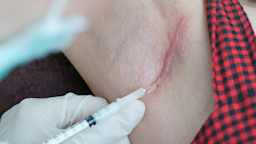 Keloid scars can look like raised, darkened areas of skin. They’re typically firm to the touch. See images of keloids and learn how to get rid of them.