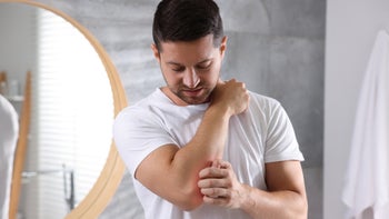 Itching: man scratching arm 1955830829