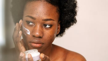 acne: woman with acne applying a face cream 2159973350
