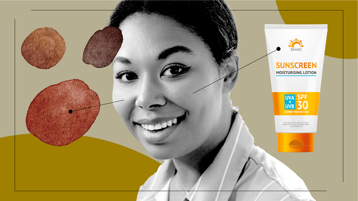 Tan background with a cutout portrait of a young Black woman. On both sides of her are items representing facial dark spots and the use of hydroquinone. On the left side are brown watercolor circles and spots. On the right side is an SPF 30 sunscreen tube. 