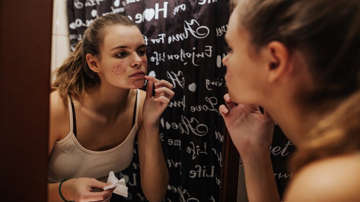 A young adult looks at acne in the bathroom mirror.