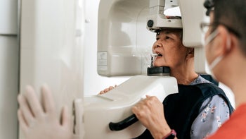 Health: Dental care: senior woman dental xray 1423894660