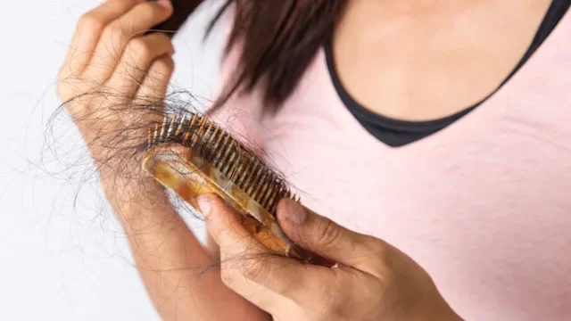 COVID-19: Hair loss: brush full of hair 1305655753