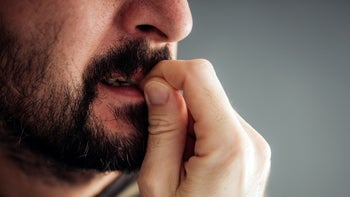 Dermatology: closeup man biting nails 925647672