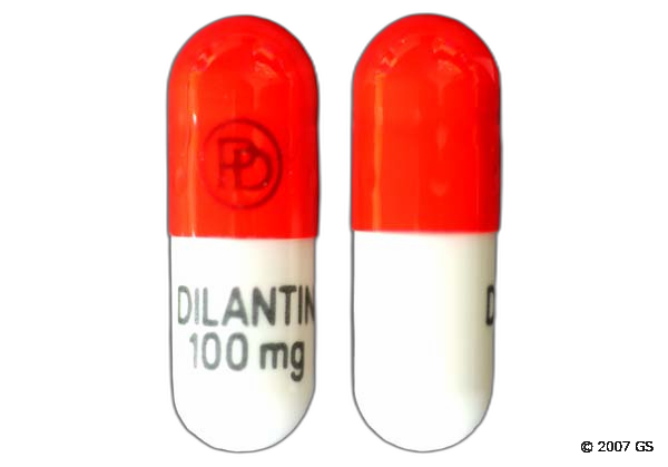 Dilantin