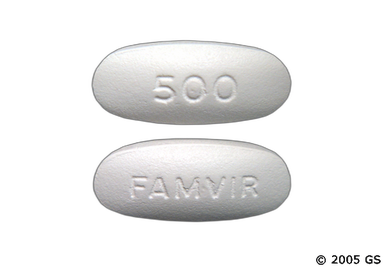Cost of generic famvir