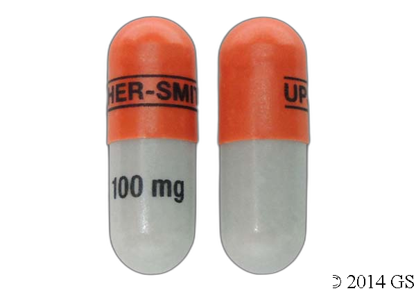 Topiramate ER (Qudexy XR)