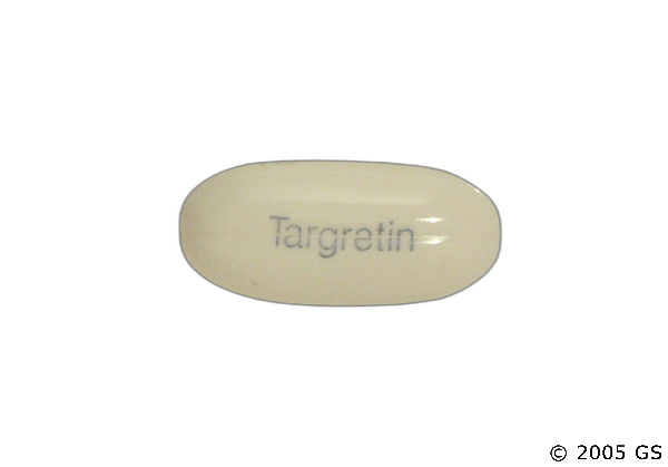 generic Targretin