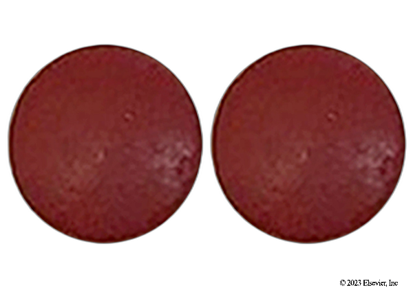 generic Fer-Iron
