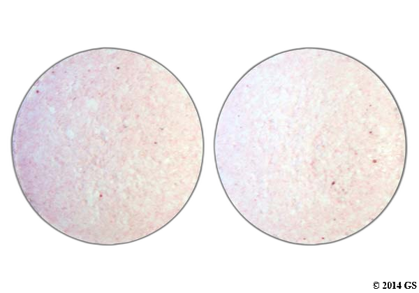 Vitamin B12
