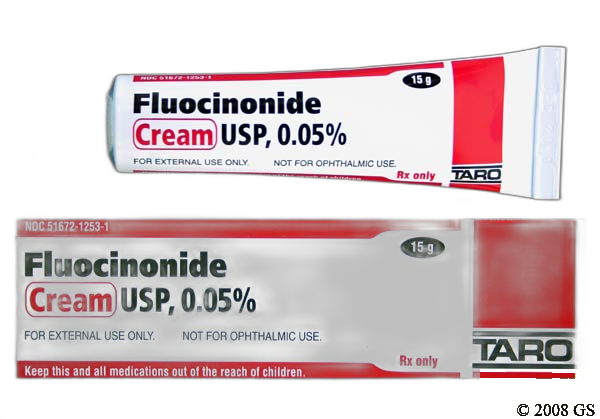 Fluocinonide