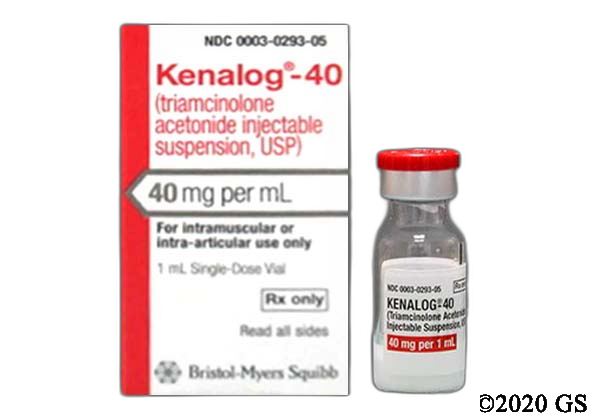Kenalog