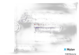 Insulin Glargine Coupon - Insulin Glargine five 3ml prefilled pens of 100 units/ml carton