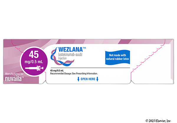 Wezlana